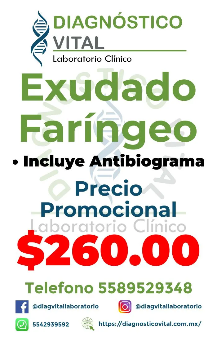 Exudado Faringeo_20_11zon
