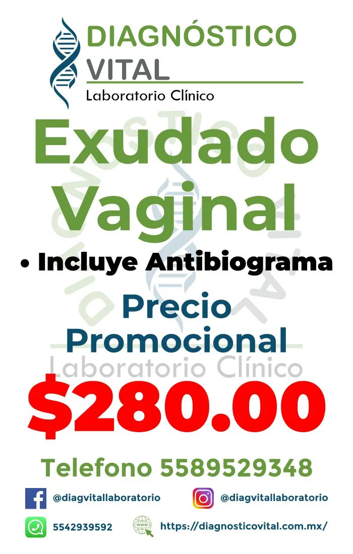 Exudado vaginal_17_11zon