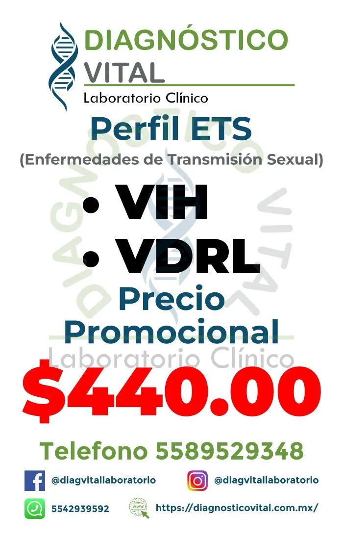 PERFIL ETS_11_11zon