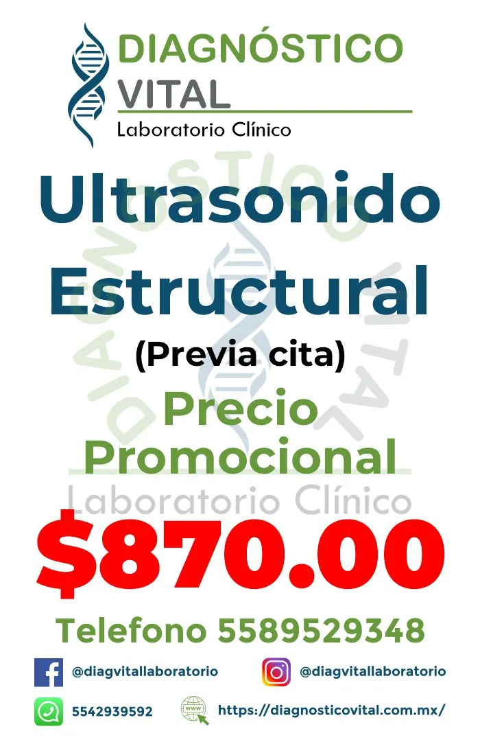 USG Estructural_1_11zon