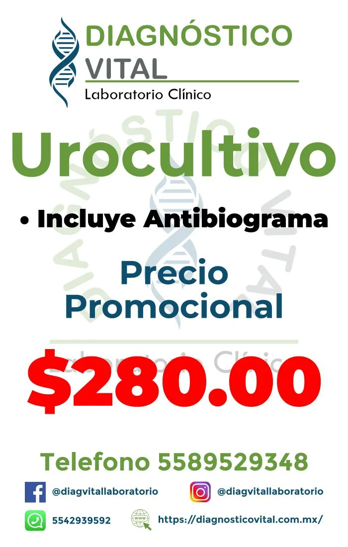 Urocultivo_14_11zon